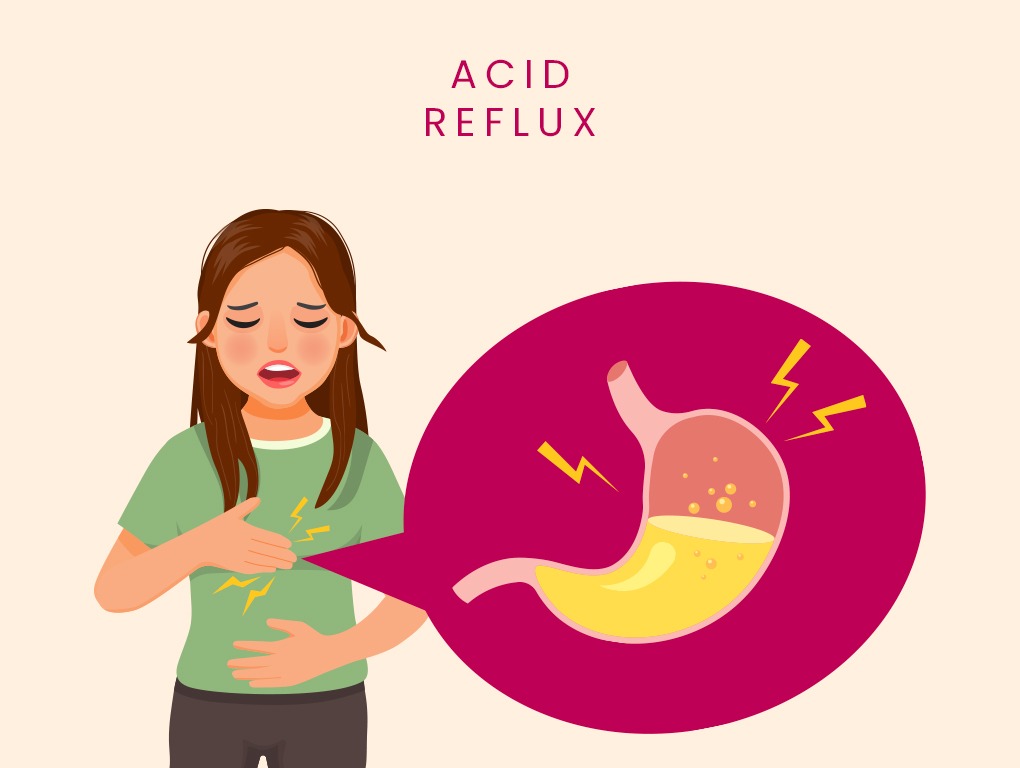 acid reflux symptoms