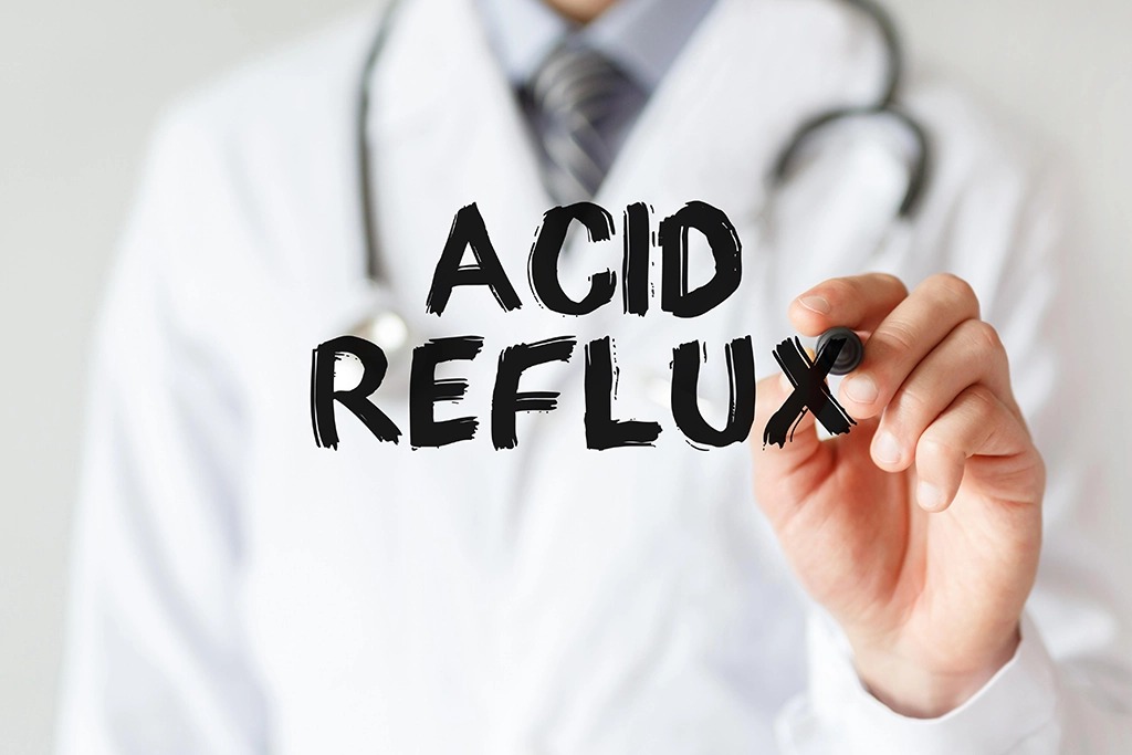 acid reflux treatment